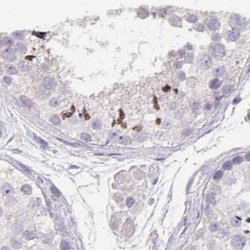 Invitrogen KIAA1751 Polyclonal Antibody 100 &mu;L; Unconjugated:Antibodies,