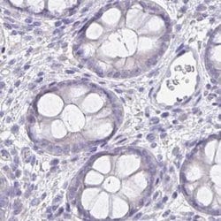 Invitrogen KIAA1751 Polyclonal Antibody 100 &mu;L; Unconjugated:Antibodies,