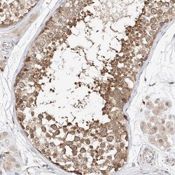 DIRAS3 Polyclonal Antibody, Invitrogen 100 &mu;L; Unconjugated:Antibodies,