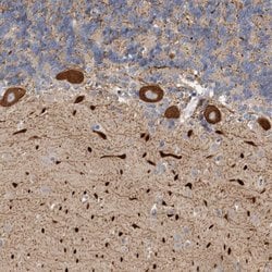 Invitrogen KIF26B Polyclonal Antibody 100 &mu;L; Unconjugated:Antibodies,