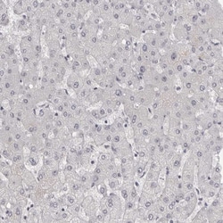 Invitrogen NUDT18 Polyclonal Antibody 100 &mu;L; Unconjugated:Antibodies,