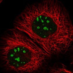 Invitrogen RBM34 Polyclonal Antibody 100 &mu;L; Unconjugated:Antibodies,