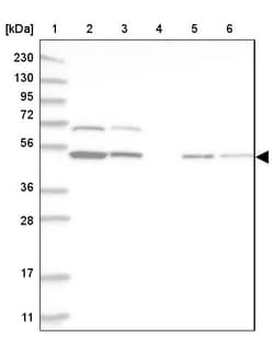 Invitrogen RBM34 Polyclonal Antibody 100 &mu;L | Buy Online | Invitrogen&trade; | Fisher Scientific