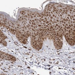 Invitrogen RBM34 Polyclonal Antibody 100 &mu;L; Unconjugated:Antibodies,