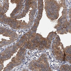 Invitrogen GEMIN8 Polyclonal Antibody 100 &mu;L; Unconjugated:Antibodies,