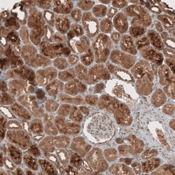 Invitrogen RAB11FIP3 Polyclonal Antibody 100 &mu;L; Unconjugated:Antibodies,