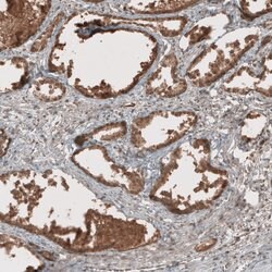 Invitrogen RAB11FIP3 Polyclonal Antibody 100 &mu;L; Unconjugated:Antibodies,