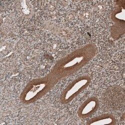 Invitrogen RAB11FIP3 Polyclonal Antibody 100 &mu;L; Unconjugated:Antibodies,