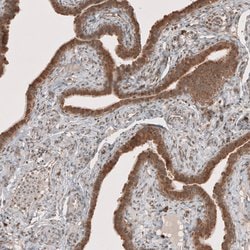 Invitrogen RAB11FIP3 Polyclonal Antibody 100 &mu;L; Unconjugated:Antibodies,