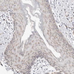 Invitrogen KDF1 Polyclonal Antibody 100 &mu;L; Unconjugated:Antibodies,
