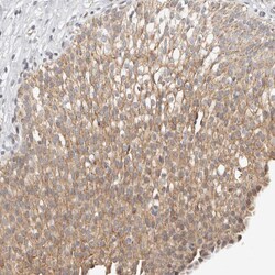 Invitrogen KDF1 Polyclonal Antibody 100 &mu;L; Unconjugated:Antibodies,