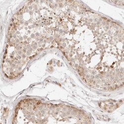 Invitrogen GPR156 Polyclonal Antibody 100 &mu;L; Unconjugated:Antibodies,