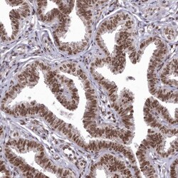 Invitrogen C1orf77 Polyclonal Antibody 100 &mu;L; Unconjugated:Antibodies,