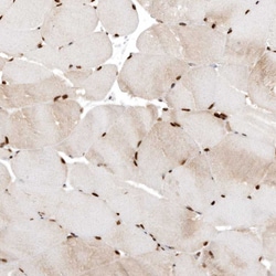 Invitrogen C1orf77 Polyclonal Antibody 100 &mu;L; Unconjugated:Antibodies,