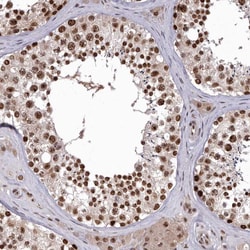 Invitrogen C1orf77 Polyclonal Antibody 100 &mu;L; Unconjugated:Antibodies,