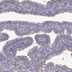 Invitrogen SPAG17 Polyclonal Antibody 100 &mu;L; Unconjugated:Antibodies,