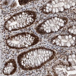 Invitrogen CHD1L Polyclonal Antibody 100 &mu;L; Unconjugated:Antibodies,
