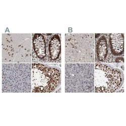 Invitrogen CHD1L Polyclonal Antibody 100 &mu;L; Unconjugated:Antibodies,