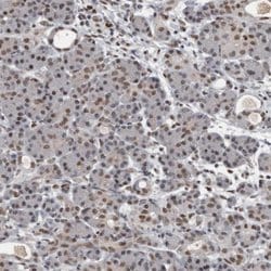 Invitrogen CHD1L Polyclonal Antibody 100 &mu;L; Unconjugated:Antibodies,