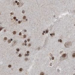 Invitrogen CHD1L Polyclonal Antibody 100 &mu;L; Unconjugated:Antibodies,