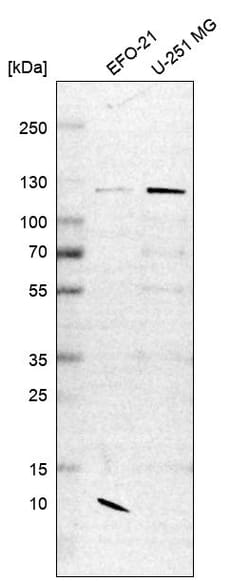 Invitrogen CHD1L Polyclonal Antibody 100 &mu;L | Buy Online | Invitrogen&trade; | Fisher Scientific