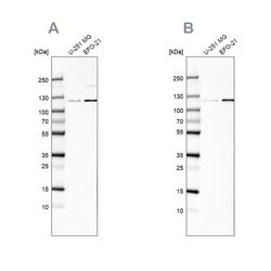 Invitrogen CHD1L Polyclonal Antibody 100 &mu;L; Unconjugated:Antibodies,