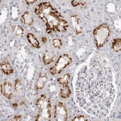 Invitrogen ESPN Polyclonal Antibody 100 &mu;L; Unconjugated:Antibodies,