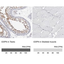 Invitrogen ESPN Polyclonal Antibody 100 &mu;L; Unconjugated:Antibodies,