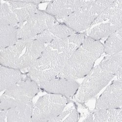 Invitrogen ESPN Polyclonal Antibody 100 &mu;L; Unconjugated:Antibodies,