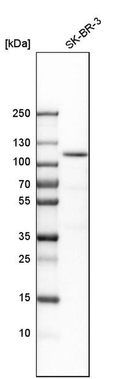 Invitrogen ESPN Polyclonal Antibody 100 &mu;L; Unconjugated:Antibodies,