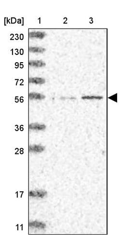 Invitrogen IQCC Polyclonal Antibody 100 &mu;L | Buy Online | Invitrogen&trade; | Fisher Scientific