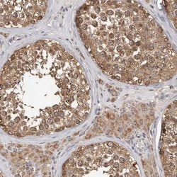 Invitrogen MTF1 Polyclonal Antibody 100 &mu;L; Unconjugated:Antibodies,