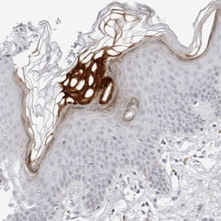 Invitrogen Filaggrin 2 Polyclonal Antibody 100 &mu;L; Unconjugated:Antibodies,
