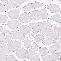 Invitrogen V-ATPase G3 Polyclonal Antibody 100 &mu;L; Unconjugated:Antikroppar