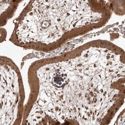 Invitrogen Rwdd1 Polyclonal Antibody 100 &mu;L; Unconjugated:Antibodies,
