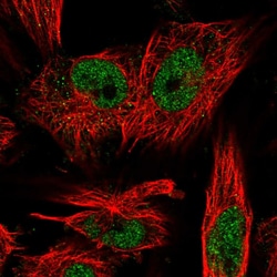 Invitrogen LRP5L Polyclonal Antibody 100 &mu;L; Unconjugated:Antibodies,