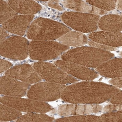Invitrogen LRP5L Polyclonal Antibody 100 &mu;L; Unconjugated:Antibodies,