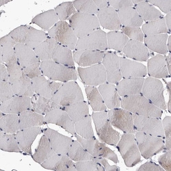 Invitrogen AUNIP Polyclonal Antibody 100 &mu;L | Buy Online | Invitrogen&trade; | Fisher Scientific