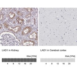 Invitrogen LAD1 Polyclonal Antibody 100 &mu;L; Unconjugated:Antibodies,