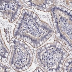 Invitrogen LAD1 Polyclonal Antibody 100 &mu;L; Unconjugated:Antibodies,