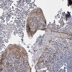 Invitrogen LAD1 Polyclonal Antibody 100 &mu;L; Unconjugated:Antibodies,