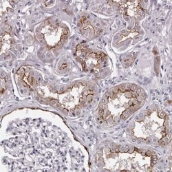 Invitrogen LAD1 Polyclonal Antibody 100 &mu;L; Unconjugated:Antibodies,