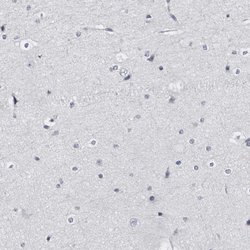 Invitrogen LAD1 Polyclonal Antibody 100 &mu;L; Unconjugated:Antibodies,