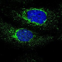 Invitrogen MECR Polyclonal Antibody 100 &mu;L; Unconjugated:Antibodies,