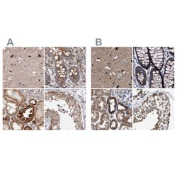 Invitrogen MECR Polyclonal Antibody 100 &mu;L; Unconjugated:Antibodies,