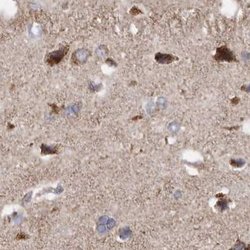 Invitrogen MECR Polyclonal Antibody 100 &mu;L; Unconjugated:Antibodies,