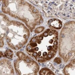 Invitrogen MECR Polyclonal Antibody 100 &mu;L; Unconjugated:Antibodies,