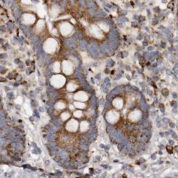 Invitrogen MECR Polyclonal Antibody 100 &mu;L; Unconjugated:Antibodies,