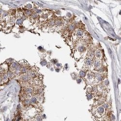 Invitrogen MECR Polyclonal Antibody 100 &mu;L; Unconjugated:Antibodies,