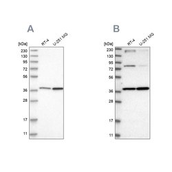 Invitrogen MECR Polyclonal Antibody 100 &mu;L; Unconjugated:Antibodies,